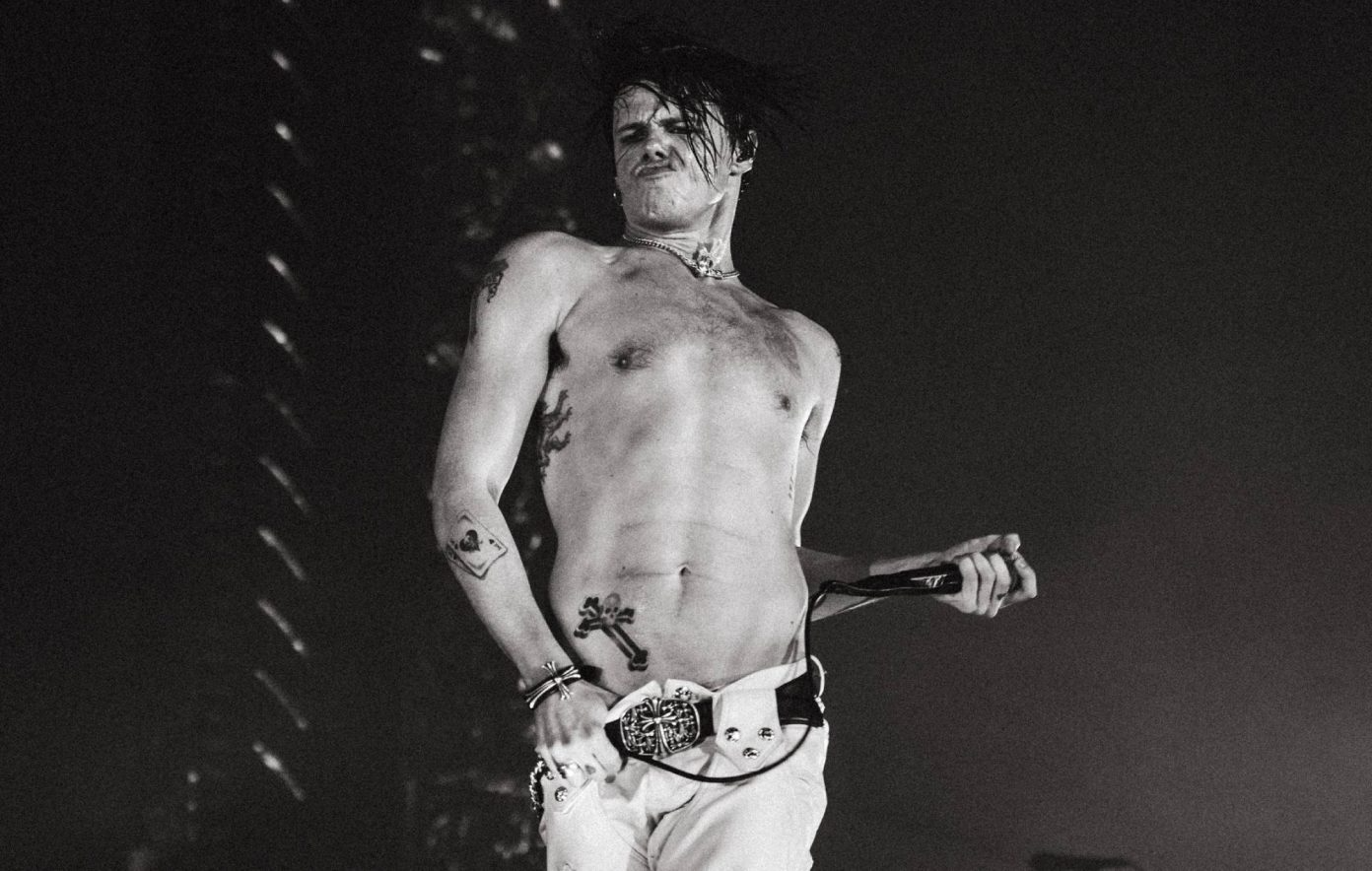 Yungblud Vows To Play European Festivals Despite Breaking His Leg